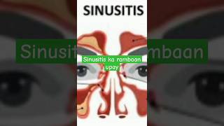 How to get rid of sinusitis sinusitis allergicrhinitis allergy ytshorts health pranyam yoga [upl. by Aierbma]