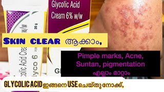 How to use glycolic Acid creamGlyco 6ww Review in malayalam [upl. by Kano]