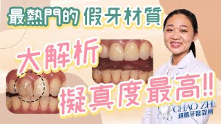 門牙樹脂填補不斷脫落｜台中牙科陳怡蓉醫師小學堂新一季開課啦！EP1 仿真度最高的假牙是什麼呢？當今最厲害的全瓷冠真的可以跟真牙相比擬嗎？ 全瓷冠 台中牙醫 [upl. by Ronacin]