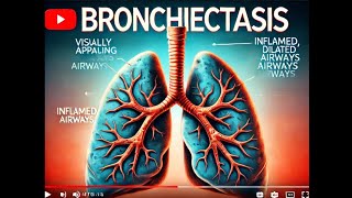 what is bronchiectasis [upl. by Nylle]