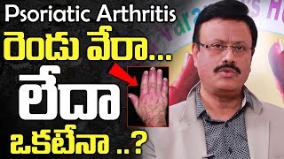 Surprising Facts Of Psoriasis which Causes Arthritis  Psoriatic Arthritis  Myra Jeevan [upl. by Nissensohn]