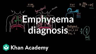 Emphysema diagnosis  Respiratory system diseases  NCLEXRN  Khan Academy [upl. by Thgiwed]