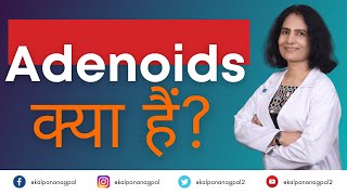 Adenoids क्या हैं ENT Surgeon I Dr Kalpana Nagpal [upl. by Attenehs643]