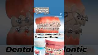 Dental Orthodontic Correction Studio fastest Smile Correction centre Alamcode Attingal Varkala [upl. by Hessney]