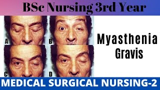 Myasthenia Gravis  MSN2  Medical Surgical Nursing  BSc Nursing 3rd Year  BSc Nursing in Hindi [upl. by Afatsuom]