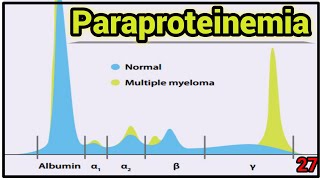 Blood  Paraproteinemia amp Multiple Myeloma  Lecture 27 [upl. by Ellswerth]