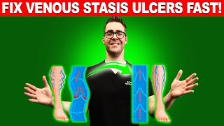 STOP Varicose Veins amp Venous Stasis Ulcers FAST [upl. by Doralyn]