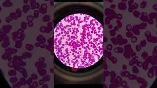 Microscopy hematology dlc tlc [upl. by Friend336]