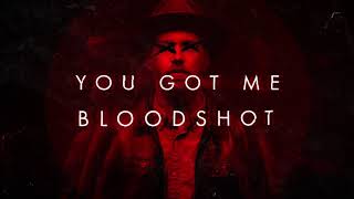 Sam Tinnesz  Bloodshot Official Lyric Video [upl. by Ponton]