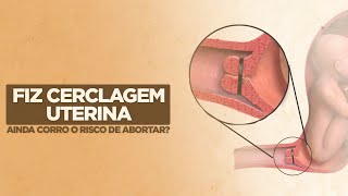 Fiz cerclagem uterina ainda corro o risco de abortar  Dra Soraia Joislane [upl. by Eleirbag122]