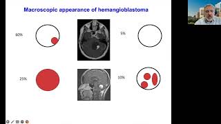 VHL 101  Dr Othon Iliopoulos MD PhD [upl. by Cyn]