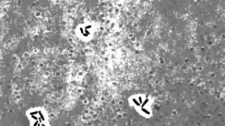 Cell growth and cell division in the rodshaped actinomycete Corynebacterium glutamicum [upl. by Lancelle]