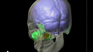 Human skull brain cast amp air sinuses  Yaw [upl. by Anelrats]