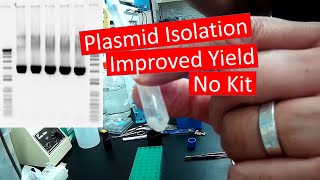 Plasmid DNA Isolation  Improved Yield No Kit [upl. by Aihsyla580]