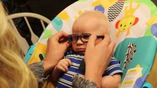 Baby with Albinism Sees Mom for First Time with Glasses [upl. by Hung628]