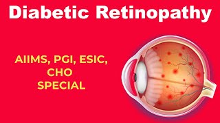 Diabetic Retinopathy in Hindi  Nirmla Kumari  Nursinginnovationhindi [upl. by Janot]