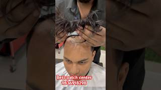 Best frontline patch mens Best hair wig centre in Kolkata Best hair cutting salon in Kolkata [upl. by Alarice]