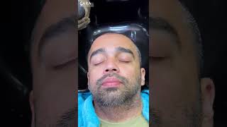 First Headwash After Hair Transplant at Cara Clinic 2024 [upl. by Kcod]