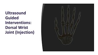 Ultrasound Guided Interventions Dorsal Wrist Joint Injection ultrasound [upl. by Nedra35]