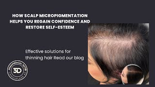 🌟 Struggling with hair loss or scars [upl. by Cristian]