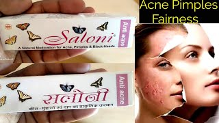 Saloni anti acne cream use or side effects in hindi [upl. by Aden672]