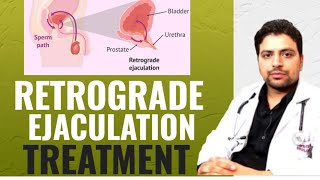 RETROGRADE EJACULATION TREATMENT  Symptoms  Causes in hindi treatment drhemantsharma [upl. by Nortad]