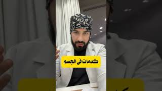 كدمات في الجسم ظهور بقع زرقاء عند النساء بدون سبب [upl. by Farr]