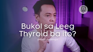 May Thyroid ba ako [upl. by Chill224]