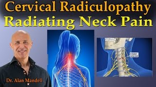 Cervical Radiculopathy Radiating Neck Pain  Dr Mandell Live Stream [upl. by Tillion]