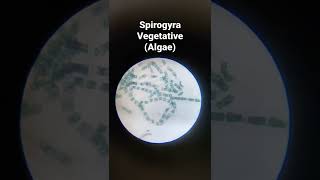 Spirogyra vegetative algae shorts [upl. by Yoong]