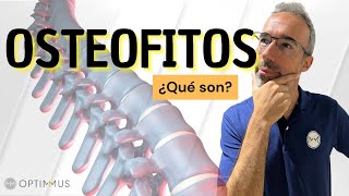 DESCUBRE la verdad de los OSTEOFITOS‼️ [upl. by Lraed]