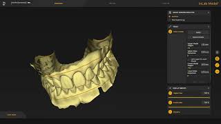 Model design in de inlab 22 software [upl. by Leodora87]