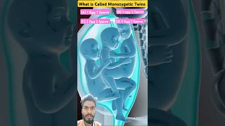 Monozygotic Twins is CalledTwins Babybaby twinmoments shortvideo [upl. by Notlaw]