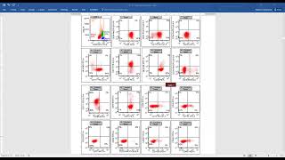 AML with NPM1 mutation [upl. by Vivia]