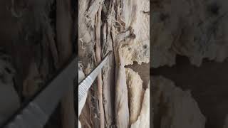 cubital fossa dissection [upl. by Uv]