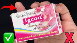 Igcon Cream Side Effects kaise thik kare  Fairness in 3 night [upl. by Daisi]