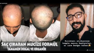 Saç Çıkaran Mucize Formül [upl. by Llerehc]