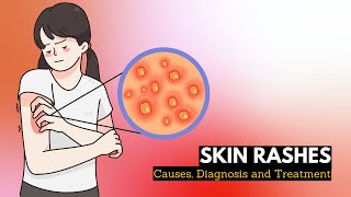 Skin Rash Causes Signs and Symptoms Diagnosis and Treatment [upl. by Eselrahc]