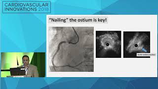 CVI2018 Session Innovation in coronary ostial lesion management  Anand Prasad MD [upl. by Rramahs]