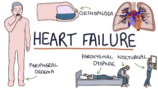 Understanding Heart Failure Visual Explanation for Students [upl. by Daenis]