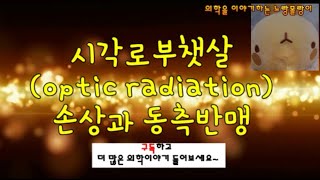 시각로부챗살optic radiation  반대쪽 동측 반맹contralateral homonymous hemianopsia Meyers loop [upl. by Tare]