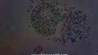 Fresh Water Oodinium cysts crack [upl. by Htezzil321]