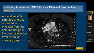 Coronary Arteries and CMR From a Different Perspective  Leila Rezai Gharai MD [upl. by Hollerman427]