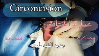 Circoncision  2025 عملية الختانة [upl. by Ibmab]