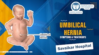 Umbilical Hernias Symptoms and treatment Options [upl. by Gage]