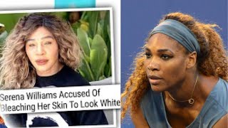 Serena Williams Speaks On Being Called Out For Lightening Her Skin [upl. by Siravrat]