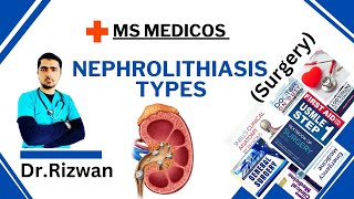 NephrolithiasisSurgeryMS MedicosDr RizwanUrdu Hindi Easy Explanations [upl. by Kacerek308]