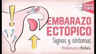 EMBARAZO ECTÓPICO 💔😭 Signos y síntomas [upl. by Grearson]