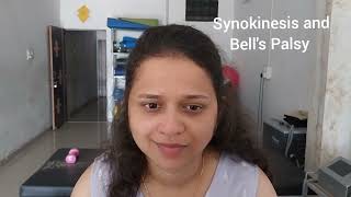 Synkinesis vs Bells Palsy Different between Synkinesis and Bells Palsy [upl. by Kcirted638]