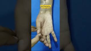 Hand Examination nerve joints pain physiotherapy stiffness mcp pip dip wristelbow shoulde [upl. by Pry480]